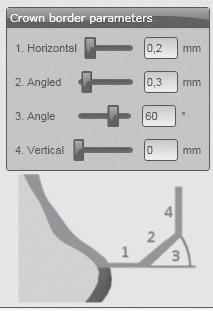 TOEPASSING Randparameters in de CAM-software Op voldoende randdikten letten. Geadviseerde waarden zijn: 1. Randdikte (Horizontal): 0,2 mm 2. Afgeschuind (Angled): 0,3 mm 3. Hoek (Angle): 60 4.