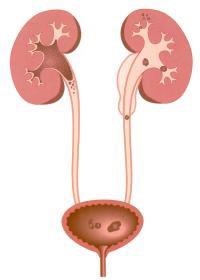 Wat zijn nierstenen? De nieren zijn grote filters waarlangs het bloed loopt.