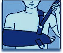 medicatie. als de hele arm opzwelt, warm en rood wordt. Immobilisatie Afhankelijk van het type operatie dient u uw arm na de operatie in een speciale draagdoek of mitella te dragen.