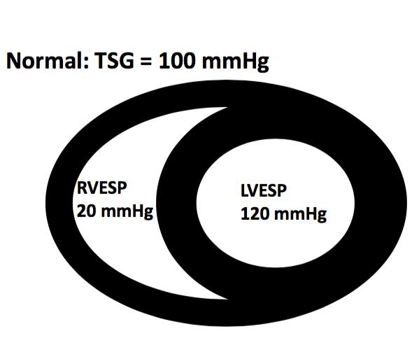 Therapie: afterload - vasopressie MAP >> RV sys druk