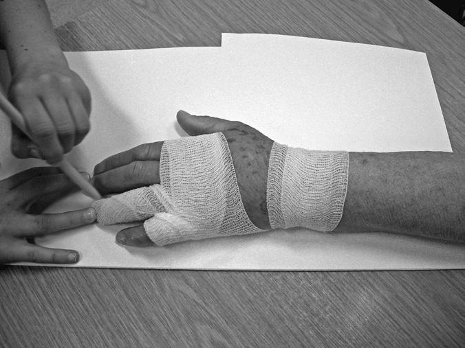 PATIËNTENINFORMATIE activiteiten door de beperkingen van de hand, dan kan de handtherapeut dit met u bespreken en eventuele adviezen geven.