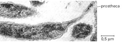 2 Bereken de vergrotingsfactor van deze foto. Bacteriën van het genus Caulobacter hebben gedurende een deel van hun levenscyclus een prostheca. Caulobacter deelt zich op een bijzondere wijze.