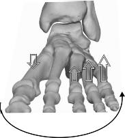 een supinatie van de achtervoet (bijvoorbeeld bij een voetafzet) een gelijktijdige pronatoire vervorming van de voorvoet genoemd (5).