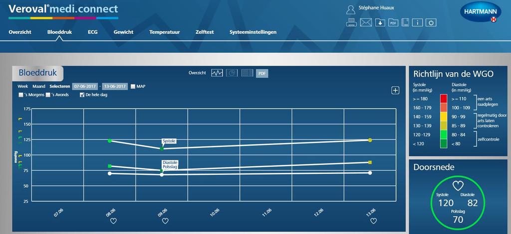 Visualisatie van uw gegevens Uw bloeddrukwaarden alsook uw hartslag worden grafisch voorgesteld.