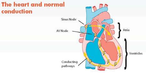 Hoe het hart normaal werkt Het hart is een spier die bloed en zuurstof moet rondpompen naar alle vitale organen in uw lichaam.
