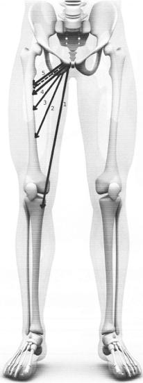 - 1.M. Gracilis - 2.M. Adductor Magnus - 3.M. Adductor Longus - 4.M. Adductor Brevis - 5.M. Pectineus Stippellijn: - M.