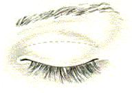 Afbeelding: markering met viltstift Uw oog wordt verdoofd met een oogdruppel. De oogarts maakt het oog schoon met jodium en u krijgt een steriele doek over uw gezicht. Uw ogen en mond blijven vrij.