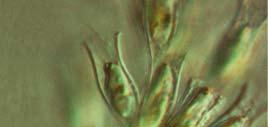 Chrysophyta, goudalgen