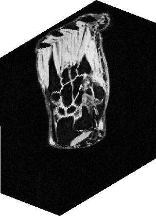 S AMENVATTING Figuur 56: 3-D Afbeelding van het polsgewricht verkregen met MRI.