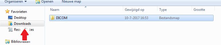 2) Het mapje wordt gekopieerd. Figuur 2.2. Kopieer de map met scans naar de locatie downloads Nadat een patiënt uit uw ziekenhuis is