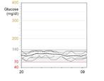 Gegevensbronnen: Gem. BG 6.3 ± 1.2 mmol/l A1C-schatting STEL DE PATRONEN VAST - INDIEN U EEN GLUCOSESENSOR GEBRUIKT 1 2 Basaal (E/h) Glucose (mmol/l) 16.7 11.1 7.8 3.9 2.