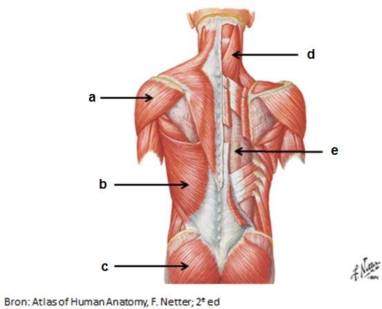 Benoem de in de afbeelding aangeduide spieren. a : b : c : d : e : (i) m. deltoideus (ii) m. erector spinae (iii) m. gluteus maximus (iv) m. gluteus medius (v) m. latissimus dorsi (vi) m.