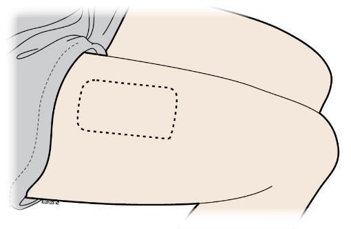 Plaatsing op de buik Plaatsing op het dijbeen OF Methode om de buik strak te trekken Trek het dijbeen niet strak.
