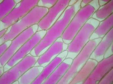 10) Op de onderstaande figuur zien we een preparaat van het epitheel van een ui. Het cytoplasma werd gekleurd. Het is duidelijk te zien dat in alle cellen het celmembraan losgekomen is van de celwand.