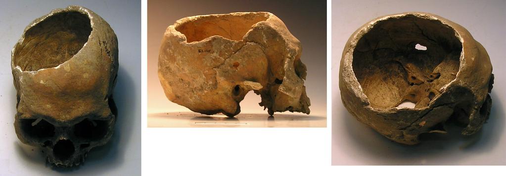 Menselijke resten in Ezinge Fig. 15 Twee schedelnapjes, bewerkte delen van menselijke schedels. Boven: 1933-1687, doorsneden 14,5 cm, datering 1e eeuw v.c. Onder: 1933-1780, doorsnede 10,5 cm, datering 1e eeuw n.