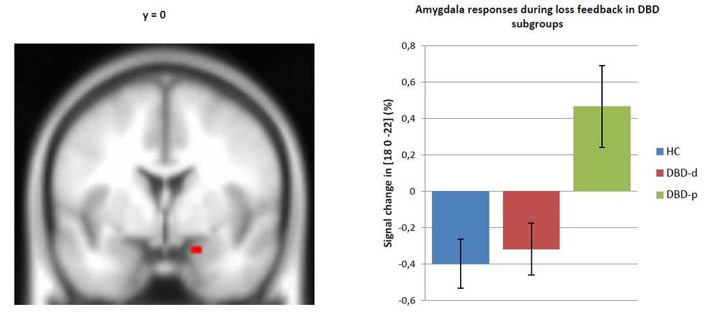 Persisters: aberrant loss processing in the amygdala
