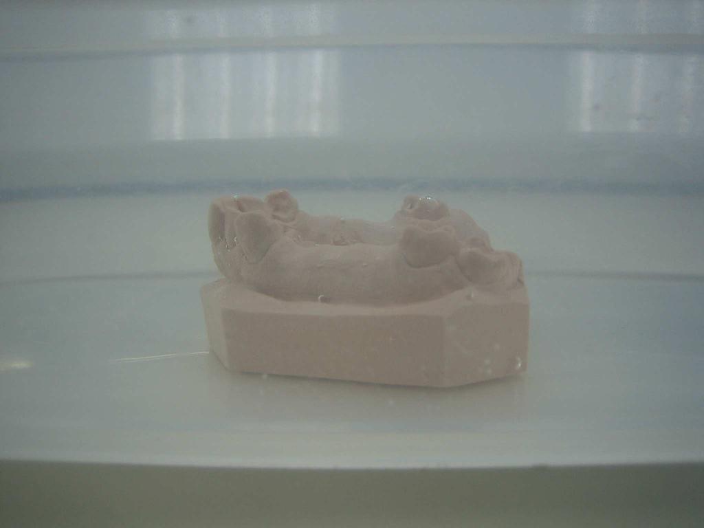 Step by step manual (frame dentures with Putty 1:1) Stap voor