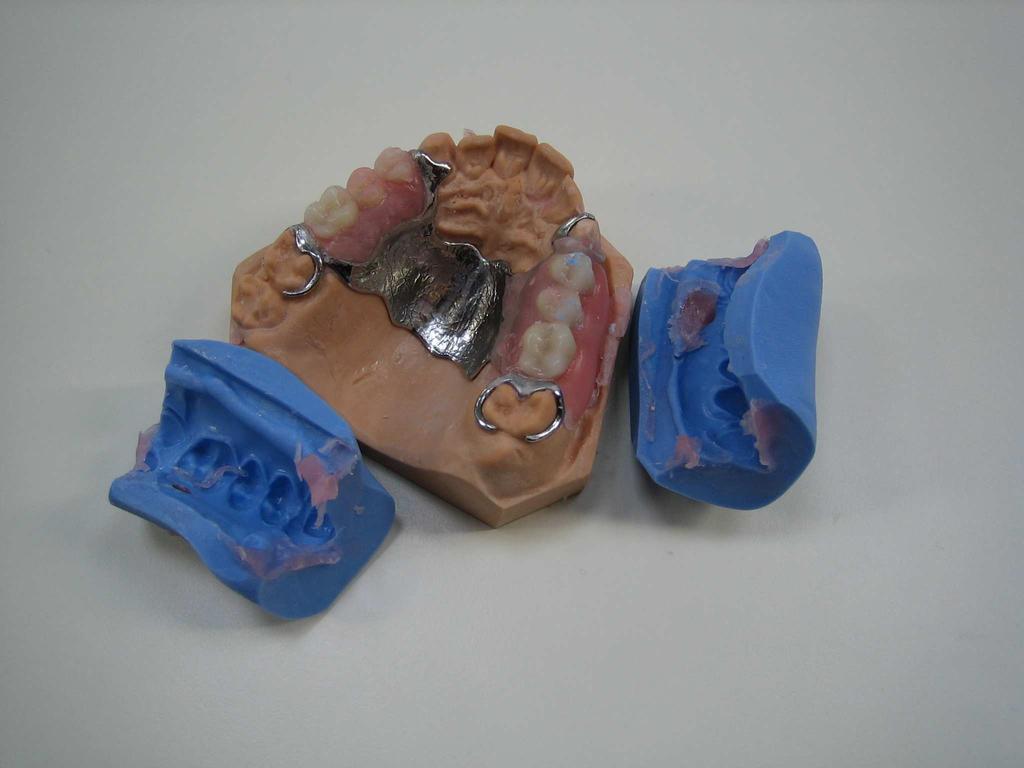 Step by step manual (frame dentures with Putty