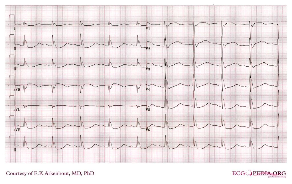 Diagnose?