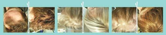 Pruiken Haarstukjes Cyberhair Haarweving Haarverdikking Haarverlenging Tulbanden & Mutsjes