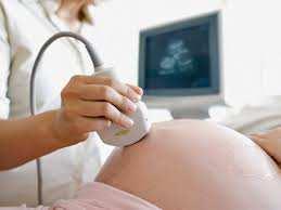 Kindercardiologisch centrum Planning neonatale opvang Bepalen bevallingsdatum zo dicht mogelijk bij a terme datum liefst