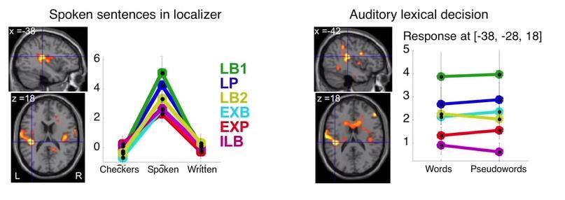 Neurale veranderingen wanneer we leren lezen?