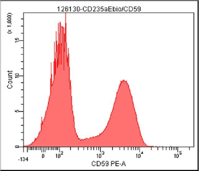 PNH HR test - RBC compensatie Type III: 56.9% Type II: 4.8% Type III: 0.09% Type II: 0.