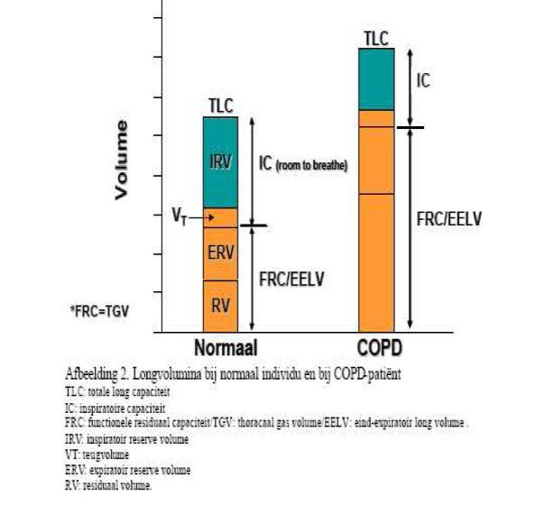 Bij licht COPD zal dit alleen tijdens inspanning gebeuren (dynamische hyperinflatie), Bij ernstig COPD ook al in rust (statische