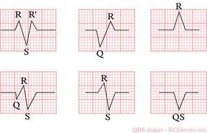 6. Terugkoppeling 6.1 uitwerking van de opgaven Antwoord opgave 1 1. De lading van de binnenkant van hartspiercel in rust is negatief 2.