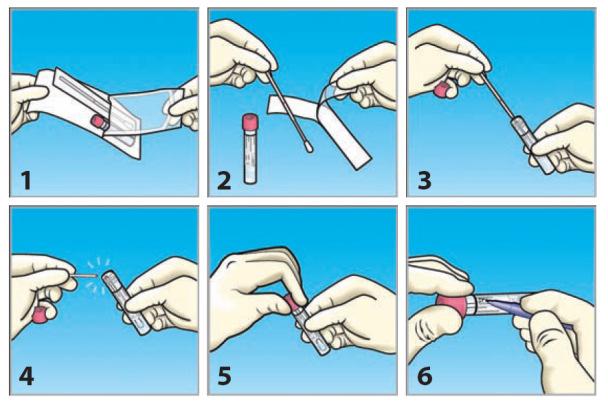 Multi-Collect Specimen Collection Kit (50/doos) Analyse van endocervicale, urethrale en vaginale wissers voor de detectie van Chlamydia trachomatis en Neisseria gonorrhoeae d.m.v. PCR 3.