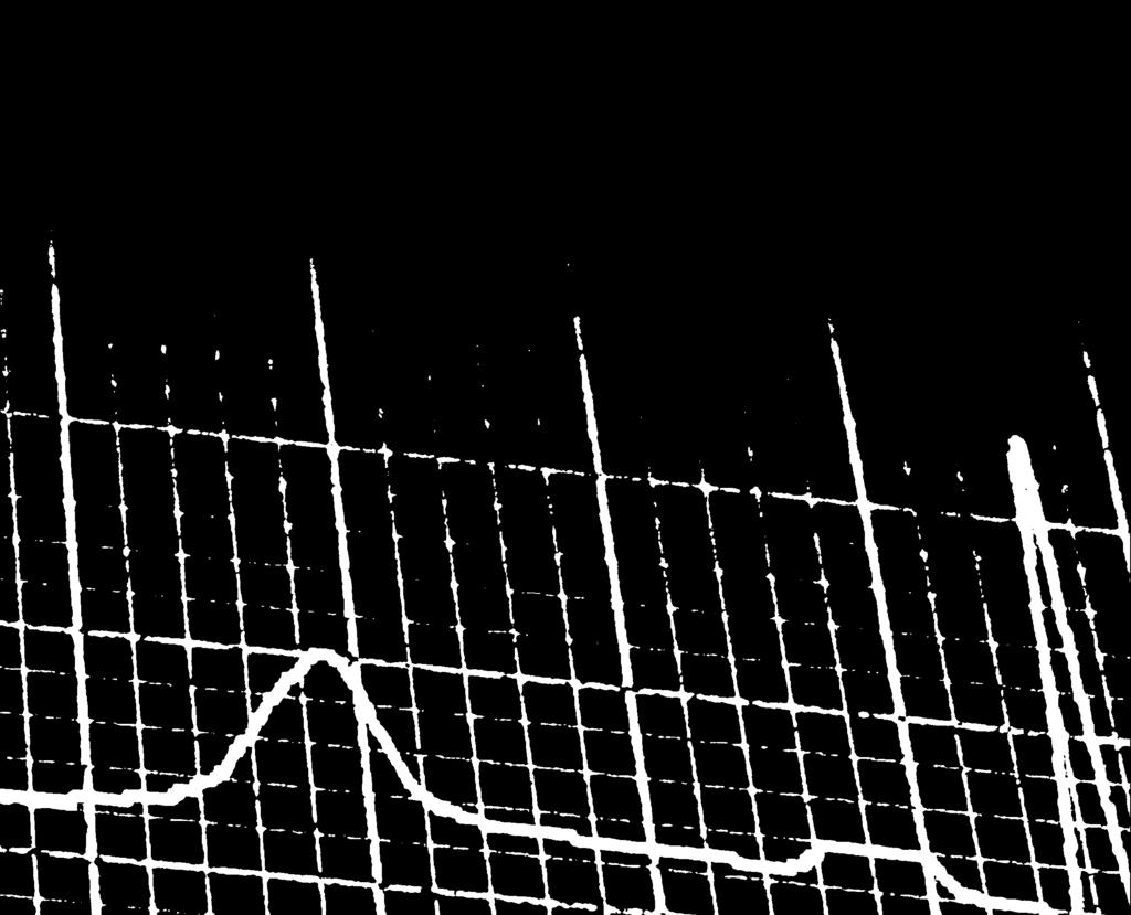 Sinds 198 werden 158 transplantaties verricht bij 142 kinderen (84 jongens en 58 meisjes) van gemiddeld 1,8 jaar oud (+/- 4,8) op het ogenblik van transplantatie.