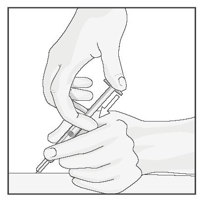 Houd met uw vrije hand de basis van de spuit vast ter ondersteuning. Duw vervolgens op de zuiger om alle oplossing langzaam en met stabiele snelheid te injecteren (zie afbeelding 4). Afbeelding 4 6.