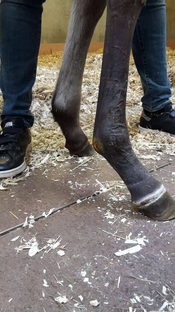 De diarree verdween achttien dagen postoperatief maar de kuur met Boulardi en Lactase werd nog drie dagen langer verdergezet.