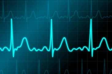 Oefening 2 Ontwerpopdracht Ontwerp een systeem dat het hartritme monitort.
