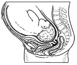 Groeivertraging van de baby Als de verloskundige of gynaecoloog vindt dat uw baby aan de kleine kant is, onderzoekt men met een echo of dit inderdaad zo is.