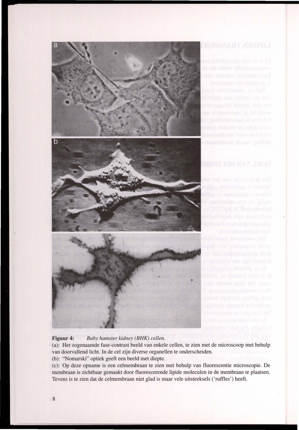 Figuur 4: Baby hamster kidney (BHK) cellen. Ca): Het zogenaamde fase-contrast beeld van enkele cellen, te zien met de microscoop met behulp van doorvallend licht.
