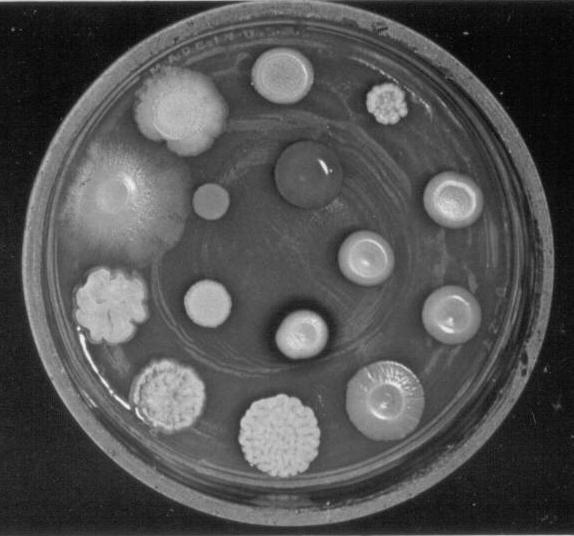 HOOFDSTUK 18: controle van de microbiële groei (Hfst. 20) 18.1 Warmtesterilisatie (= 20.1) 18.2 Sterilisatie door straling (= 20.2) 18.3 Filter sterilisatie (= 20.3) 18.