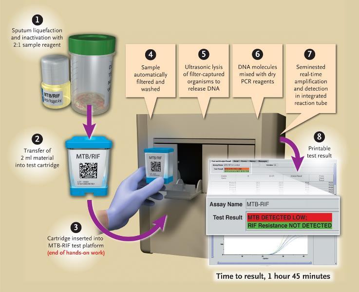 Real-time automated PCR: