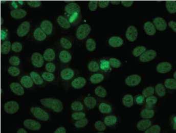 dense spikkels in het nucleoplasma van de