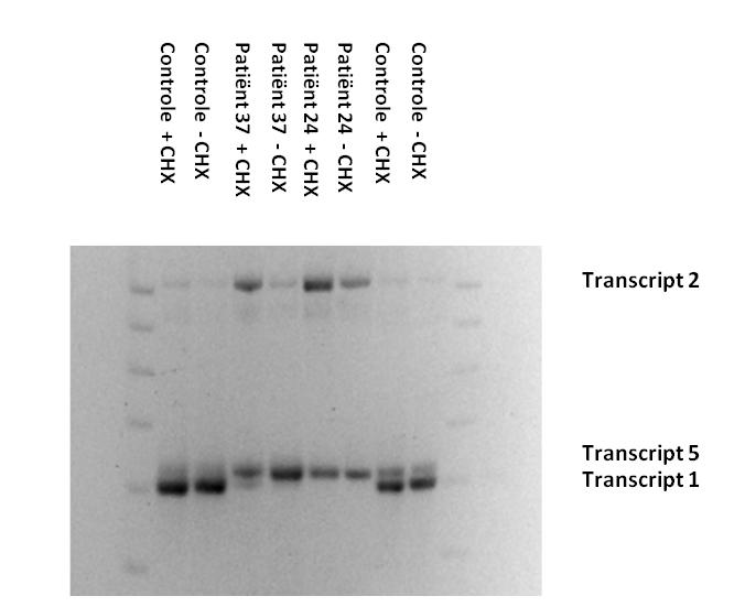 Resultaten Fig. 4.7: gevolg van splice site mutatie c.2055+18g>a ( ) op de splicing in intron 14.