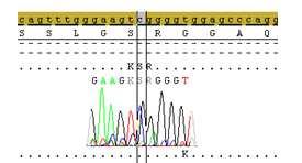 Een voorbeeld hiervan is toevoeging van cyclohexemide aan cdna. Sequenering van het cdna werd voor deze patiënten nog niet uitgevoerd. Fig. 4.10 Ho c.628c>t 4.1.5.4 variaties c.2055+17c>t en c.