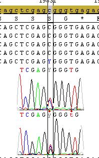 Resultaten Bij patiënt 46 is echter nog geen tweede mutatie gevonden waardoor men niet kan besluiten dat deze variatie oorzakelijk is voor het fenotype. Fig. 4.12: Patiënt 44 He c.2055