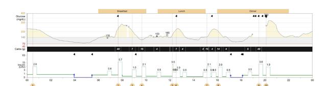 EEN PRAKTISCH STAPPENPLAN VOOR HET GEBRUIK VAN CARELINK PERSONAL Glucose (mg/dl) Dagdetails.