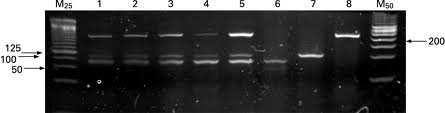 1995: overexpressie van cycline D1 is een marker voor Mantel Cel Lymfoom 1995: CyclinD1 immunohistochemie is een goede hulp bij de diagnose Mantel Cel Lymfoom Cyclin D1 messenger RNA overexpression