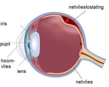 Inleiding In deze folder leest u meer over een netvliesloslating. De behandeling wordt niet in het Albert Schweitzer ziekenhuis gedaan maar in het Oogziekenhuis in Rotterdam.