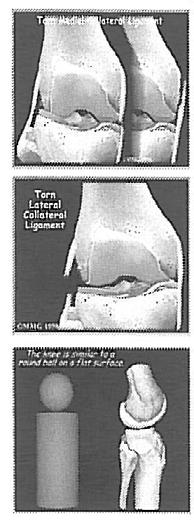 01 DE STRUCTUUR VAN DE KNIE De Fibula (kuitbeen) is het smalle bot in het onderbeen. De ligamenten (banden) verbinden de botten aan elkaar en de pezen verbinden de spieren aan de botten.