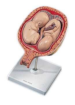 2de maand 1000323 62,40 Baarmoeder met embryo - 3de maand 1000324 66,25 Baarmoeder met