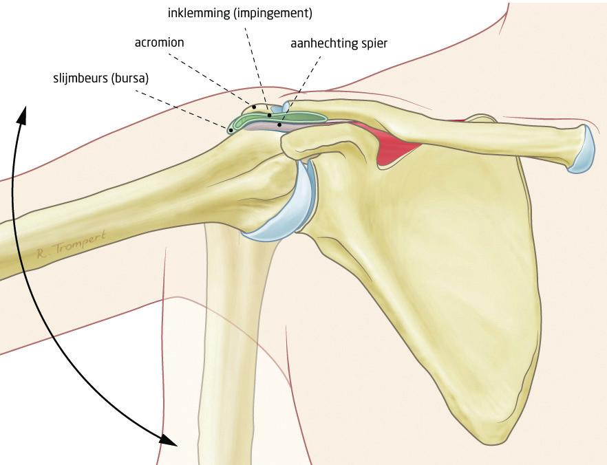 Subacromiaal pijnsyndroom (SAPS) U heeft schouderklachten, passend bij het subacromiaal pijnsyndroom. Deze folder geeft informatie over de aandoening en behandeling.