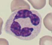 chromatinepatroon cytoplasma: ruime hoeveelheid roze kleur
