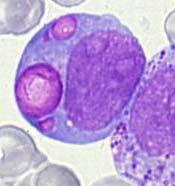 blauwachtige, groen-grijze alle leucocyten (granulocyten, lymfocyten, monocyten)